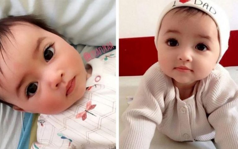 Як сьогодні виглядає дівчинка, яка народилася з унікальними та чудовими очима!